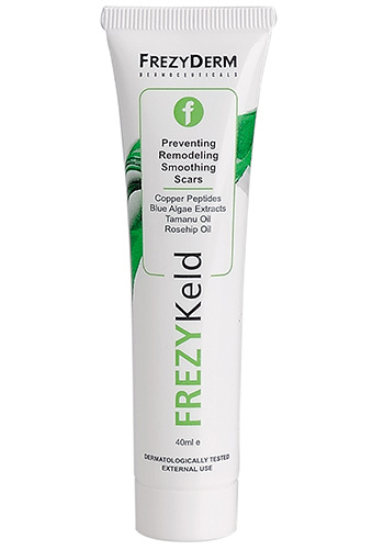 Frezykeld